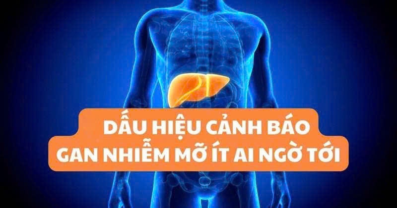 ⚠️Gan nhiễm mỡ không đau nhưng âm thầm phá hủy cơ thể – kiểm tra ngay 6 dấu hiệu này‼️ 👇👇👇