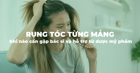 Rụng tóc từng mảng (Alopecia Areata): Khi nào cần gặp bác sĩ và hỗ trợ từ dược mỹ phẩm