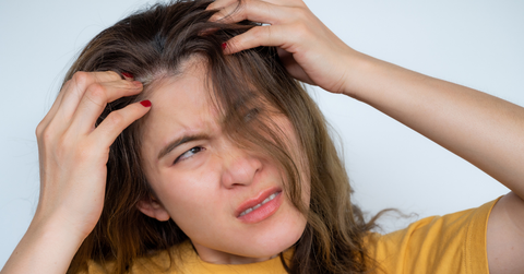 Da đầu ngứa rát sau khi ra nắng: Dấu hiệu gì và cần làm gì?