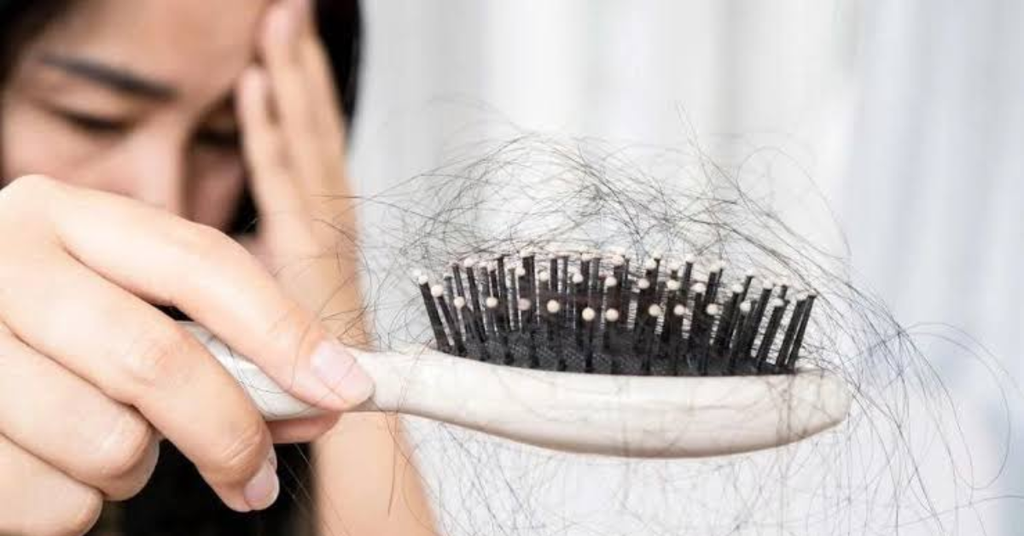 Rụng tóc nhiều: Khi nào là bình thường, khi nào cần lưu ý