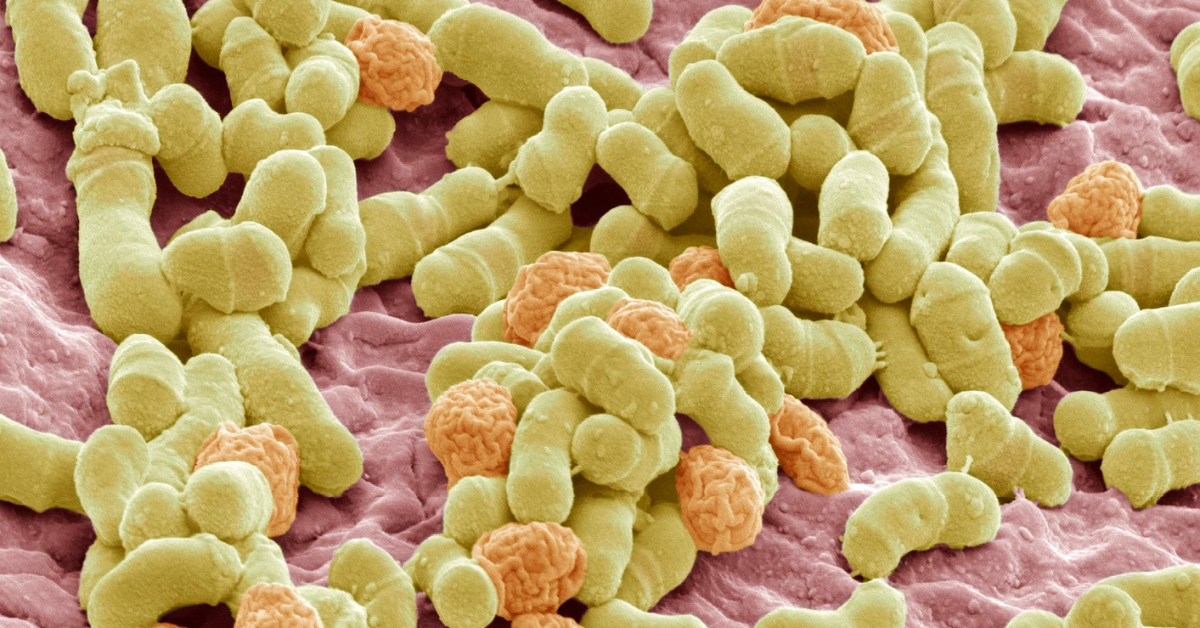 Nấm Malassezia là gì? Tại sao chúng ăn dầu thừa trên đầu bạn và cách ức chế bằng thảo dược