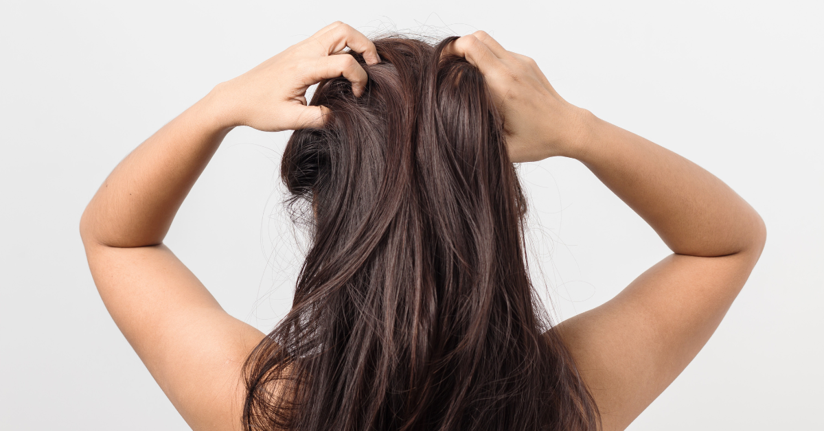 Da đầu ngứa châm chích về đêm dù mới gội đầu: Cảnh báo nấm hay da đầu quá khô?