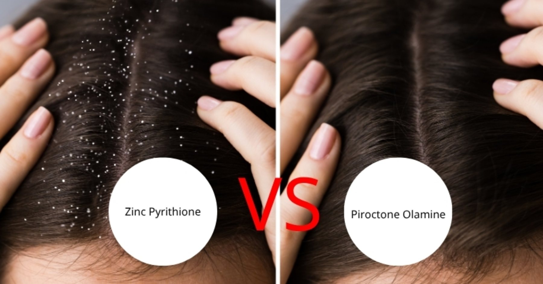 Piroctone Olamine có an toàn hơn Zinc Pyrithione không?