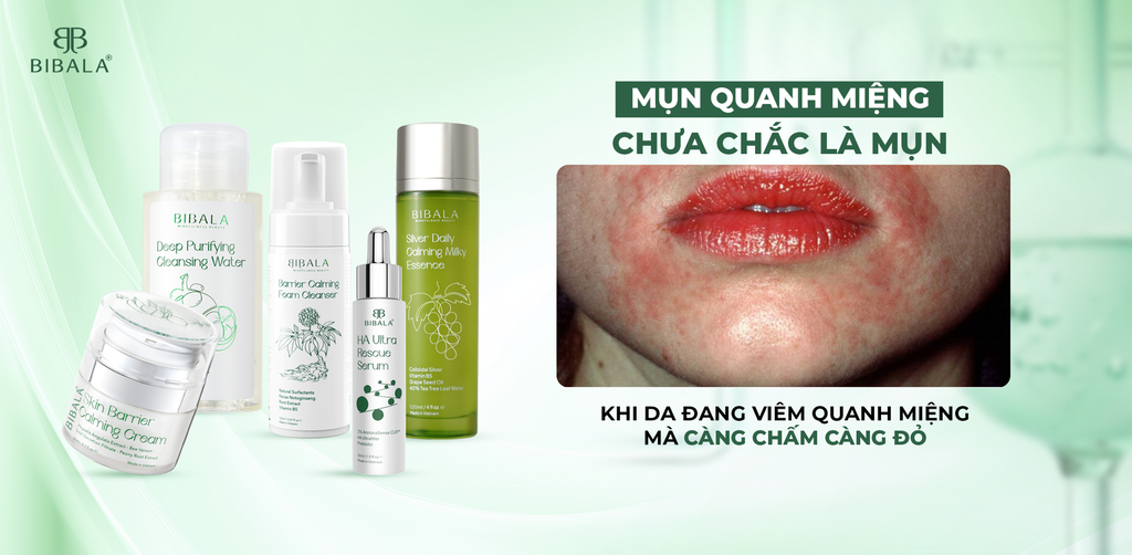 “MỤN QUANH MIỆNG” CHƯA CHẮC LÀ MỤN: KHI DA ĐANG VIÊM QUANH MIỆNG MÀ CÀNG CHẤM CÀNG ĐỎ