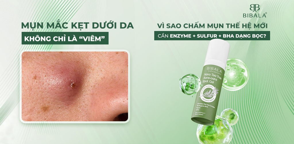 MỤN MẮC KẸT DƯỚI DA KHÔNG CHỈ LÀ “VIÊM” - VÌ SAO CHẤM MỤN THẾ HỆ MỚI CẦN ENZYME + SULFUR + BHA DẠNG BỌC?