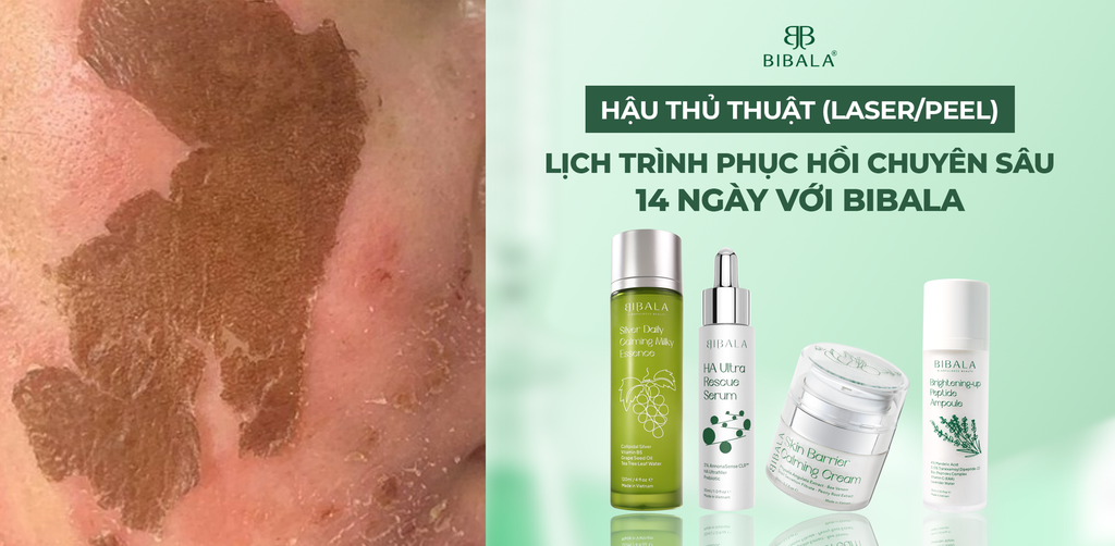 HẬU THỦ THUẬT (LASER/PEEL) - LỊCH TRÌNH PHỤC HỒI CHUYÊN SÂU 14 NGÀY VỚI BIBALA