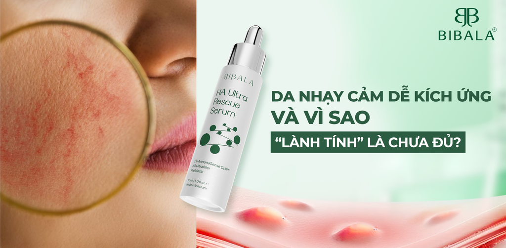 DA NHẠY CẢM DỄ KÍCH ỨNG VÀ VÌ SAO “LÀNH TÍNH” LÀ CHƯA ĐỦ?