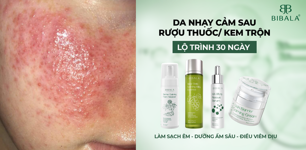 DA NHẠY CẢM SAU RƯỢU THUỐC/ KEM TRỘN - LỘ TRÌNH 30 NGÀY: LÀM SẠCH ÊM - DƯỠNG ẨM SÂU - ĐIỀU VIÊM DỊU