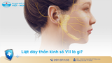 Liệt dây thần kinh số VII (Liệt mặt) nguy hiểm như thế nào?