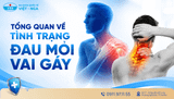 5 sai lầm khiến đau mỏi vai gáy kéo dài và cách xử trí