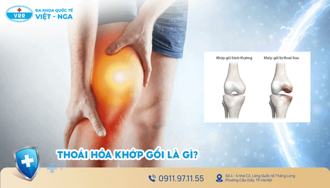 Thoái hóa khớp gối và những biến chứng nguy hiểm nếu không điều trị kịp thời