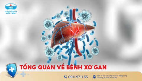 Bệnh xơ gan: Các giai đoạn phát triển và cách phát hiện sớm để bảo vệ lá gan khỏe mạnh