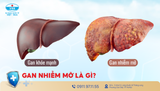 Hiểu đúng về bệnh gan nhiễm mỡ – căn bệnh thầm lặng nhưng nguy hiểm