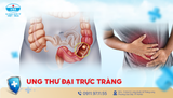 Ung thư đại trực tràng: Dấu hiệu nhận biết, chẩn đoán và phòng ngừa hiệu quả