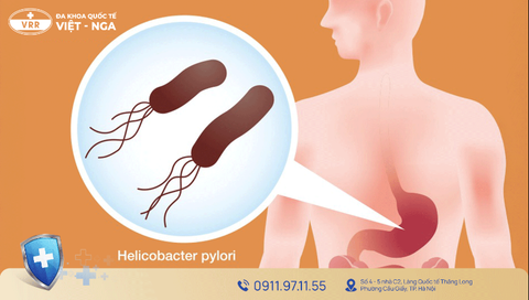 NHIỄM KHUẨN H. PYLORI (HP): DẤU HIỆU, NGUY CƠ, CHẨN ĐOÁN VÀ CÁCH ĐIỀU TRỊ