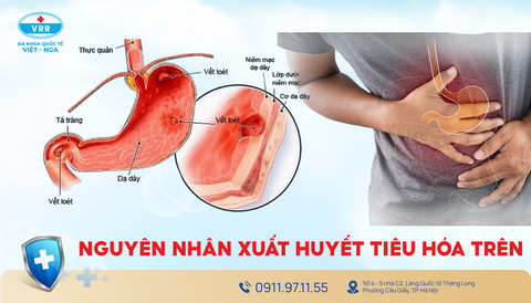 Đừng coi thường Xuất huyết tiêu hóa
