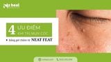 4 ưu điểm của phương pháp trị mụn cóc bằng gel chấm từ Neat Feat