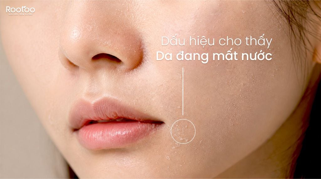 DẤU HIỆU CHO THẤY DA ĐANG MẤT NƯỚC