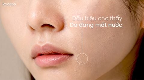 DẤU HIỆU CHO THẤY DA ĐANG MẤT NƯỚC