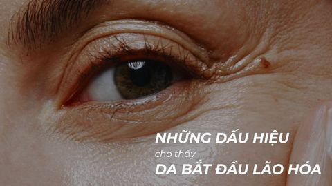 NHỮNG DẤU HIỆU CHO THẤY DA BẮT ĐẦU LÃO HÓA