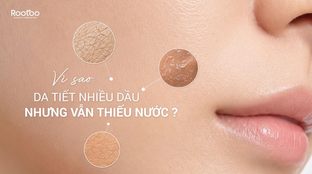 VÌ SAO DA TIẾT NHIỀU DẦU NHƯNG VẪN THIẾU NƯỚC?