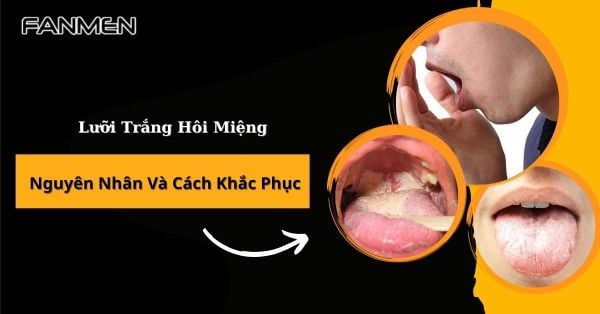 Lưỡi Trắng Hôi Miệng: Nguyên Nhân Và Cách Khắc Phục