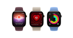 Apple Watch Series 12 vs Series 11: Có gì khác biệt?