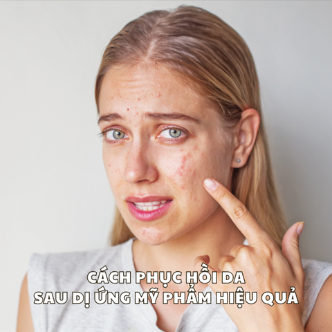 CÁCH PHỤC HỒI DA SAU DỊ ỨNG MỸ PHẨM HIỆU QUẢ