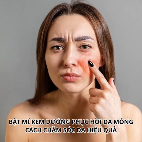 BẬT MÍ KEM DƯỠNG PHỤC HỒI DA MỎNG VÀ CÁCH CHĂM SÓC DA HIỆU QUẢ
