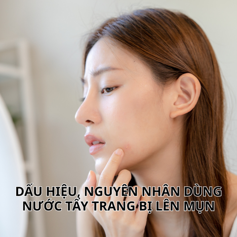 DẤU HIỆU, NGUYÊN NHÂN DÙNG NƯỚC TẨY TRANG BỊ LÊN MỤN
