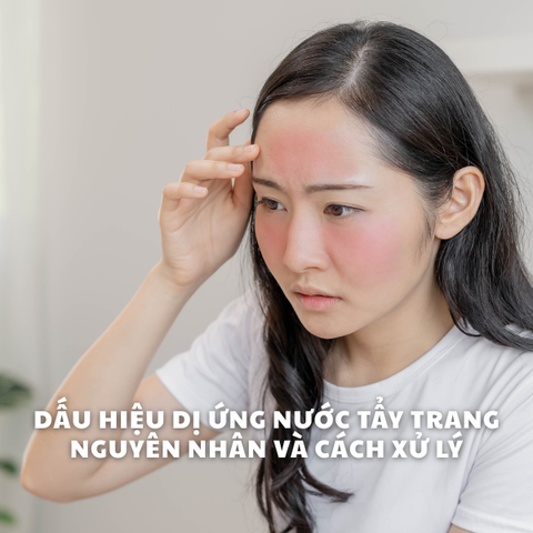 DẤU HIỆU DỊ ỨNG NƯỚC TẨY TRANG: NGUYÊN NHÂN VÀ CÁCH XỬ LÝ