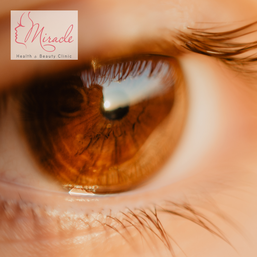 DẤU HIỆU CẢNH BÁO BỆNH VỀ MẮT