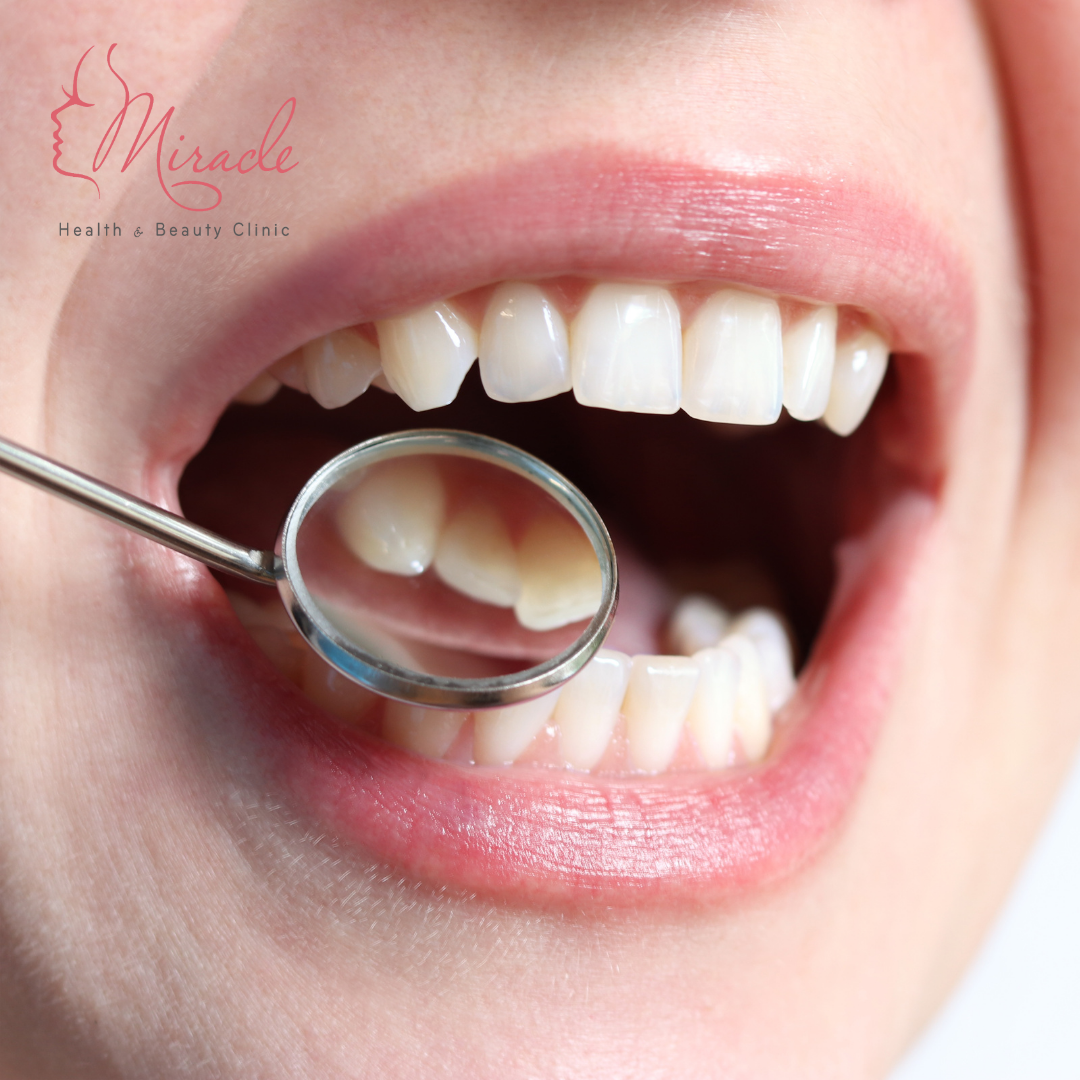 CẢM GIÁC CÓ VỊ KIM LOẠI TRONG MIỆNG LÀ BỊ GÌ?