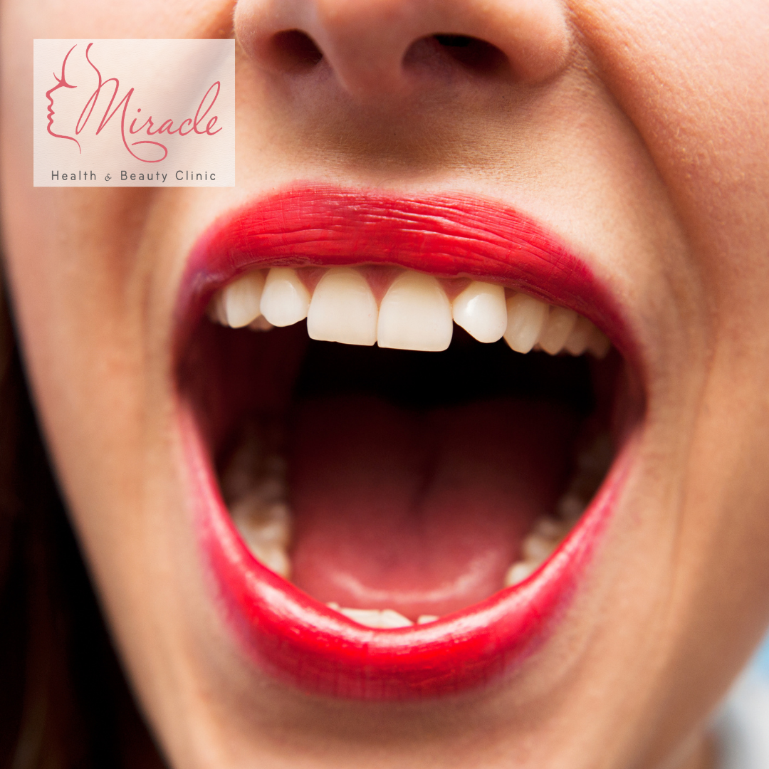 BỆNH THƯỜNG GẶP TRONG KHOANG MIỆNG