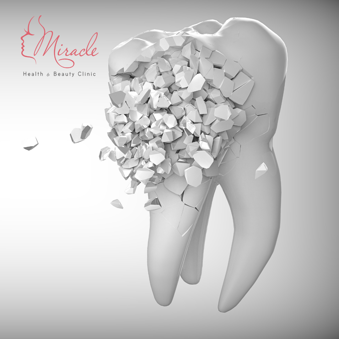 THÓI QUEN “HỦY HOẠI” RĂNG