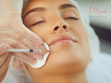 Tiêm Filler Cằm