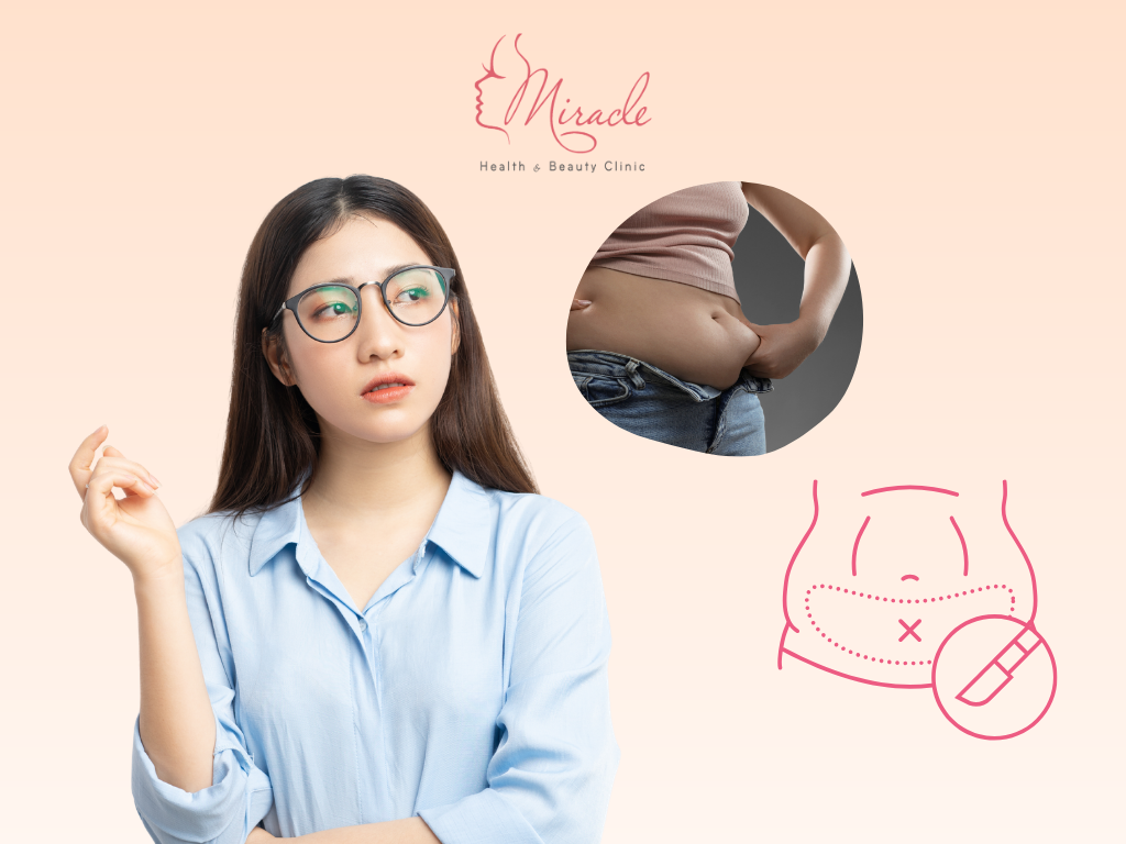 TẠO HÌNH THÀNH BỤNG Ở ĐÂU TỐT?
