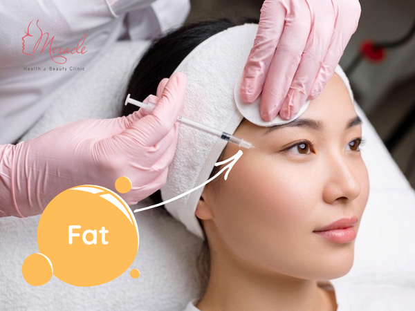 CẤY MỠ THÁI DƯƠNG BAO NHIÊU TIỀN?