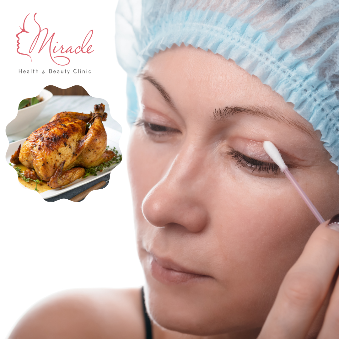 Cắt Mí Bao Lâu Thì Ăn Được Thịt Gà?