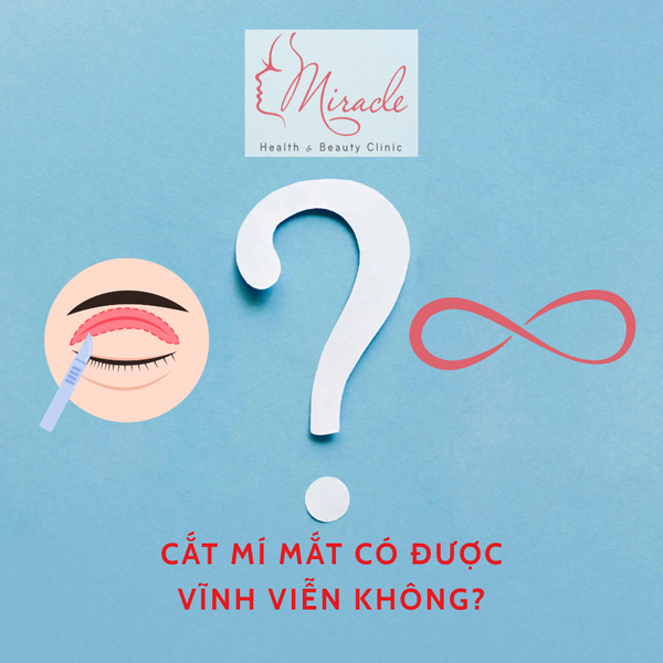 Cắt Mí Mắt Có Được Vĩnh Viễn Không?