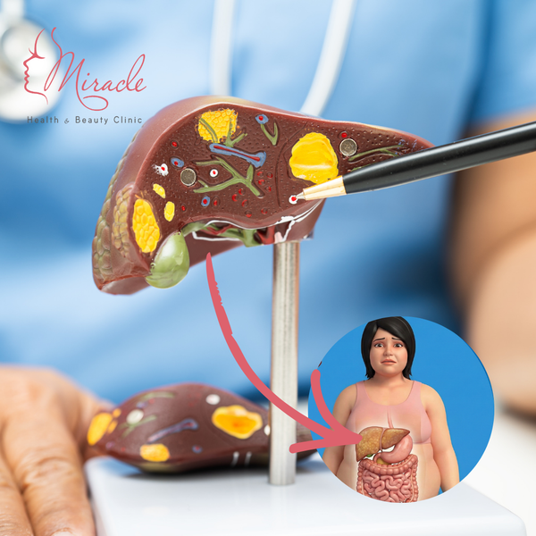 CÂU HỎI THƯỜNG GẶP VỀ GAN NHIỄM MỠ VÀ BÉO PHÌ