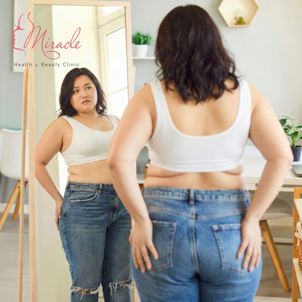 NHỮNG LẦM TƯỞNG PHỔ BIẾN VỀ BÉO PHÌ