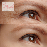 NGĂN NGỪA LÃO HÓA DA VÙNG MẮT