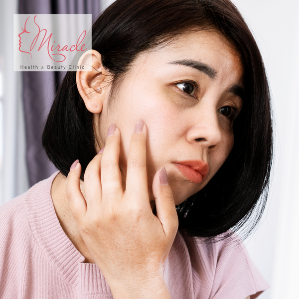 QUẦNG THÂM MẮT - NGUYÊN NHÂN VÀ CÁCH KHẮC PHỤC