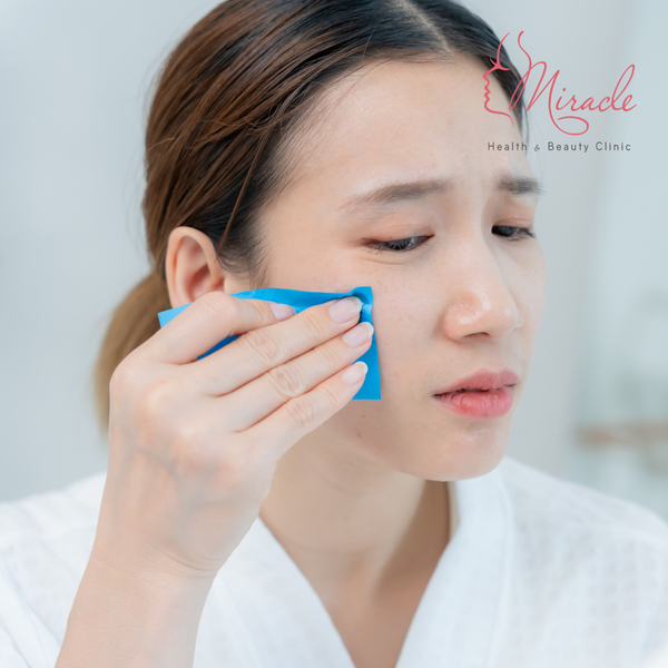 ĐIỀU NÊN VÀ KHÔNG NÊN LÀM ĐỂ KIỂM SOÁT DA DẦU