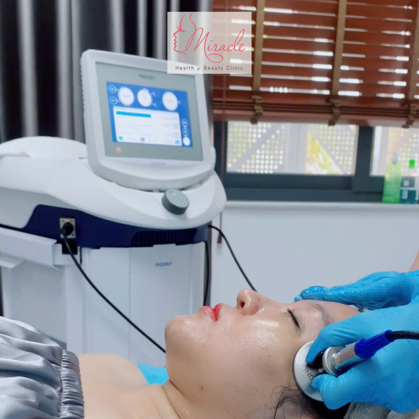 Nâng Cơ RF Có An Toàn Không?