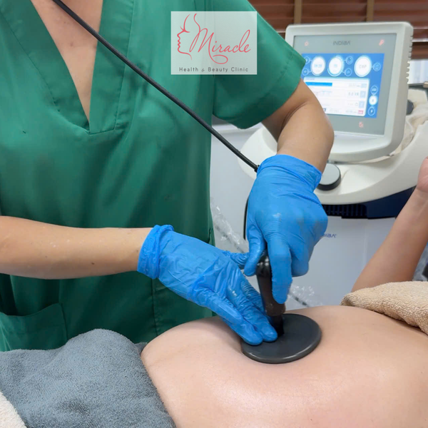 Giảm Mỡ Bằng Máy RF Có An Toàn Không?