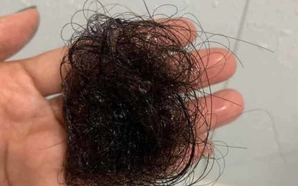 Review thực tế sản phẩm Dr.Graft sau 1 tháng sử dụng