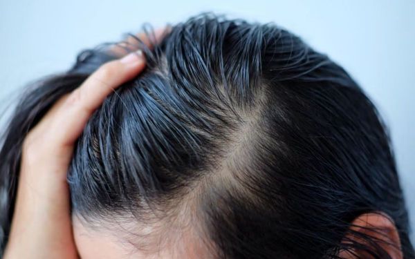 Tóc dầu và cách lựa chọn sản phẩm phù hợp