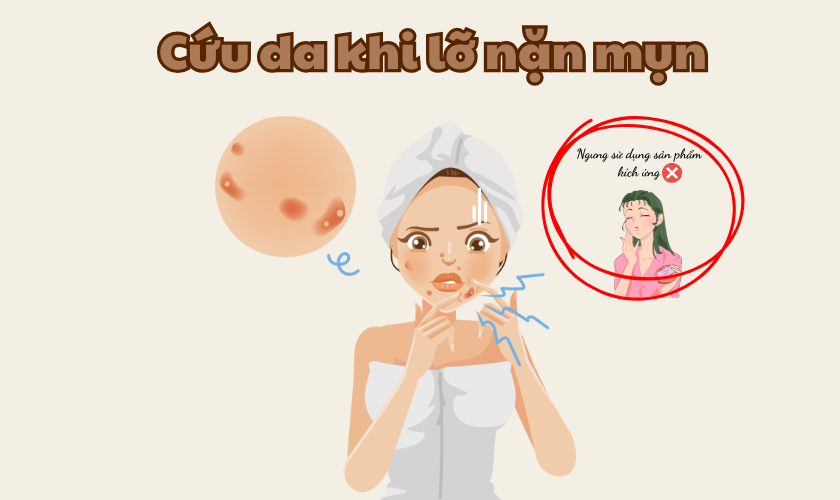 Cách Cứu Da Khi Lỡ Nặn Mụn Sai Cách – Chuyên Gia Chỉ 5 Bước Xử Lý Nhanh Với Acne Remover & Serum B5GF Renoskin